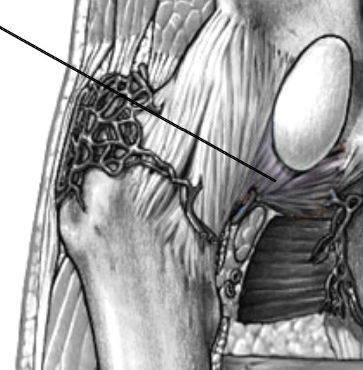 <p>Which ligament of the hip is located on the anterior and inferior aspect of the hip joint?</p>