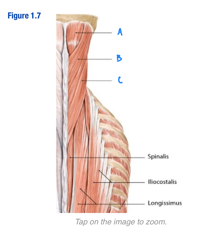 <p>Oblique running muscles</p><p>“Middle” of the 3 capitis/cervicis muscles</p><p>Sueprior to splenis cervicis</p><p>Include letter in diagram</p>