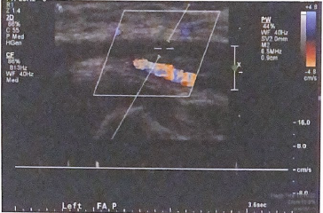 <p>List three good technical practices used to document the occlusion in this image</p>