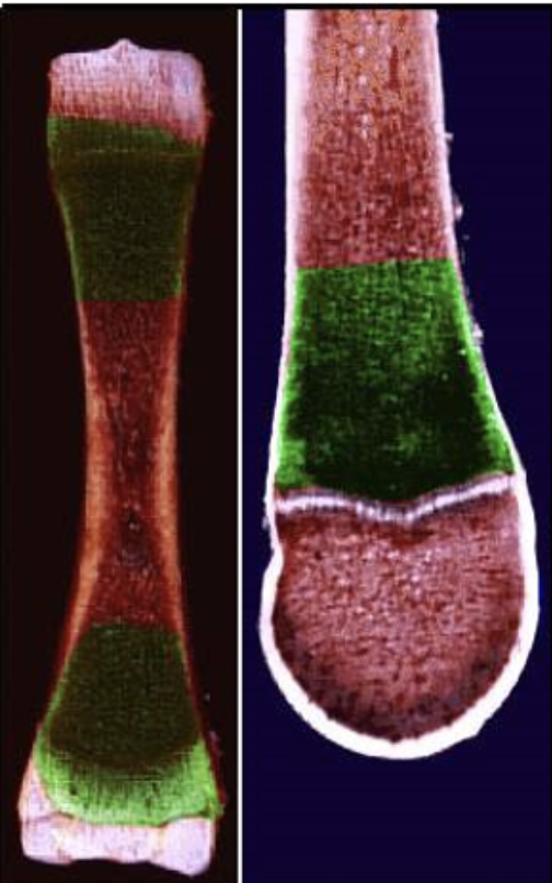 <p>what area in the bone is this called?</p>