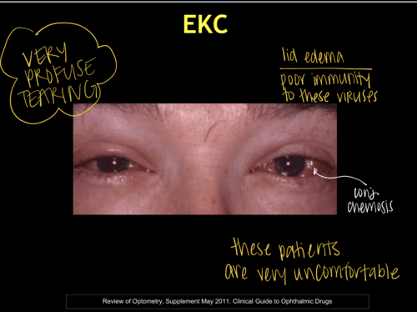 <p>EKC (Pic)</p>