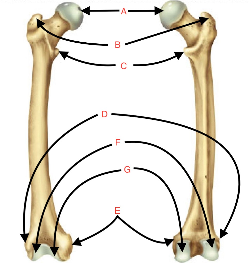 <p>What is the name of this bone?</p>