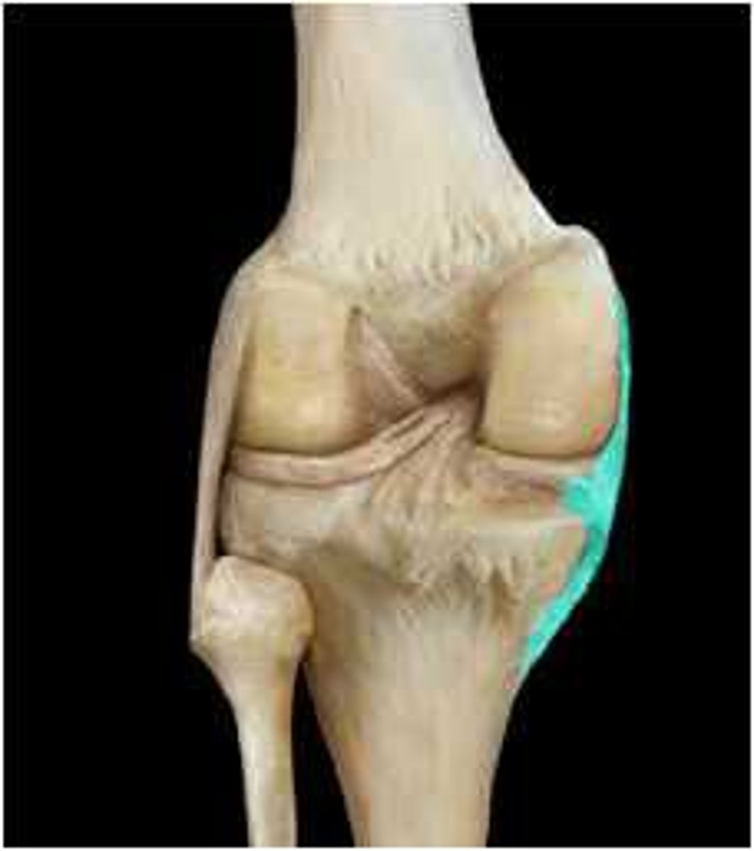 <p>- extracapsular ligament; adds strength to joint medially</p><p>- Connects medial femoral condyle to medial condyle and proximal shaft of tibia</p><p>- Fused with outer margin of medial meniscus</p>