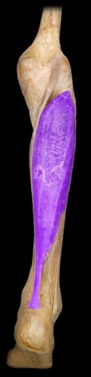 <p>What is the name of this muscle, highlighted in purple?</p>