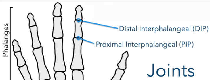 <p>Between middle phalanges &amp; distal phalanges</p>