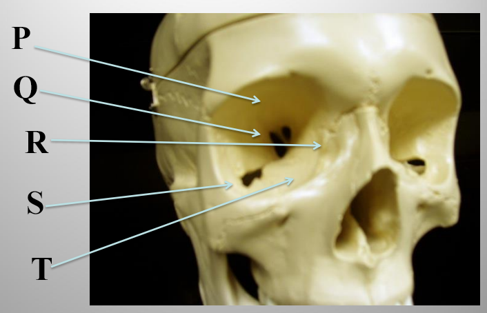 <p>What structure is letter T?</p>