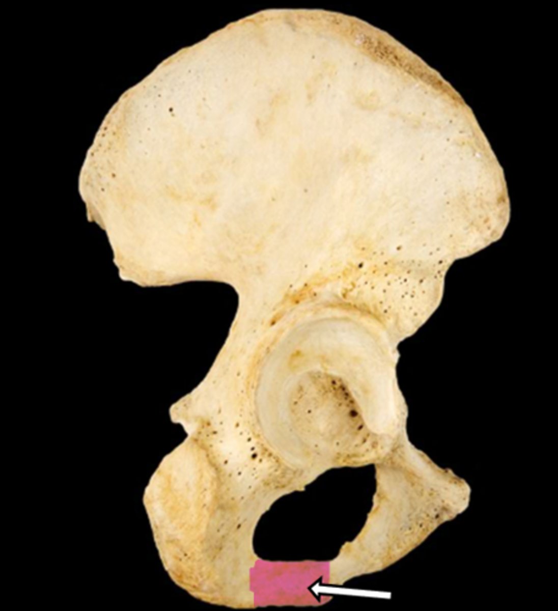 <p>name the part</p>