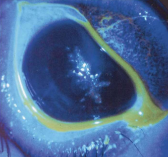 <p>What condition is this?</p>
