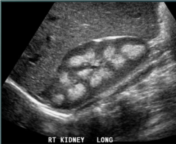 <p>Which pathology is this?</p>