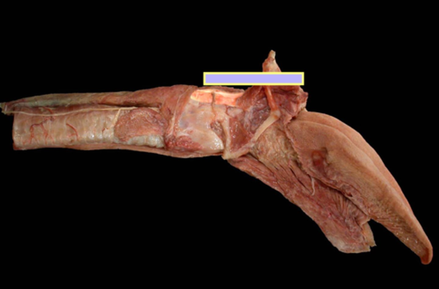 <p>Muscles of the pharynx:</p><p>pharyngeal shorteners (swallowing)</p>