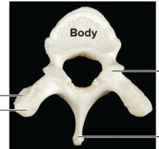 <p>What kind of vertebre is this</p>