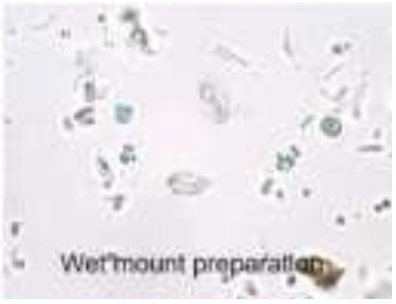 ADDITIONAL INFORMATION: Chilomastix Mesnili:

identify the stain used: 

* unstained, refractile components under the microscope