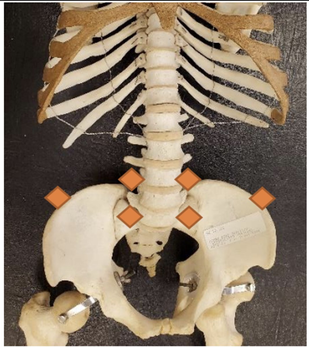 <p>1/2 distance between umbilicus and pubic symphysis</p>