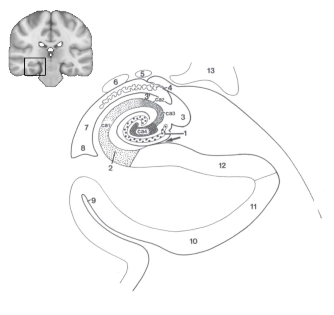 <p>What is ca1, ca2, ca3 and ca4?</p>