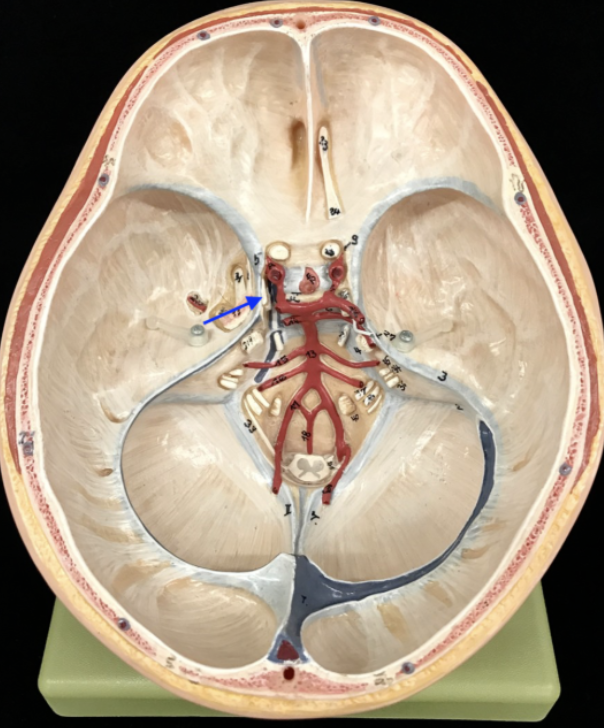 <p>What is the cranial nerve and roman numeral?</p>
