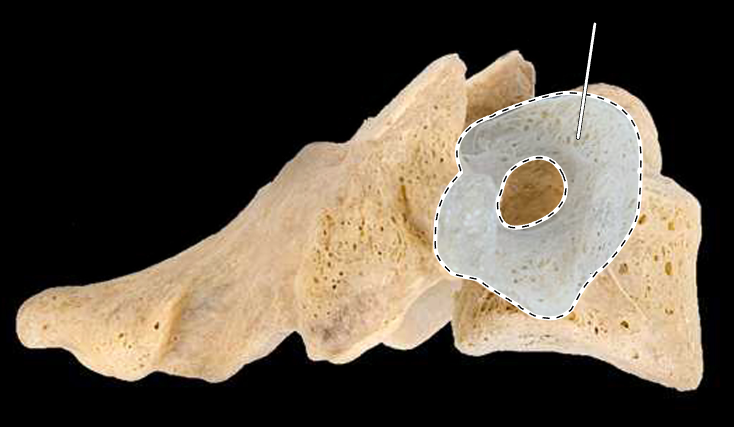 <p>What part of the vertebra is highlighted?</p><p>What type of vertebra is this (which region is this vertebra from)?</p><p>(Lateral view, right side).</p>