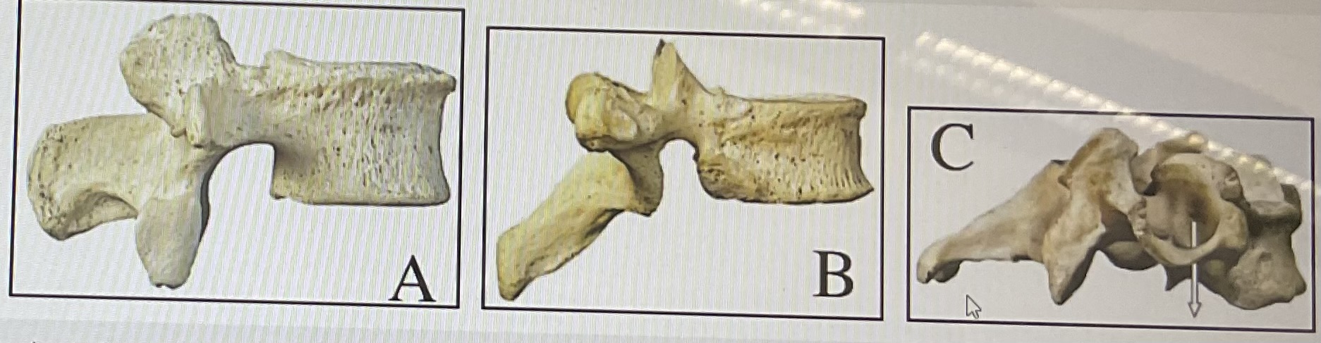 <p>based on the figure above identify each type of vertebrae </p>