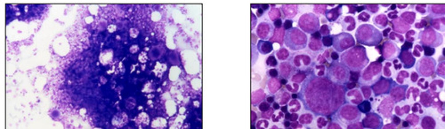<p>Semi-liquid bone marrow</p>