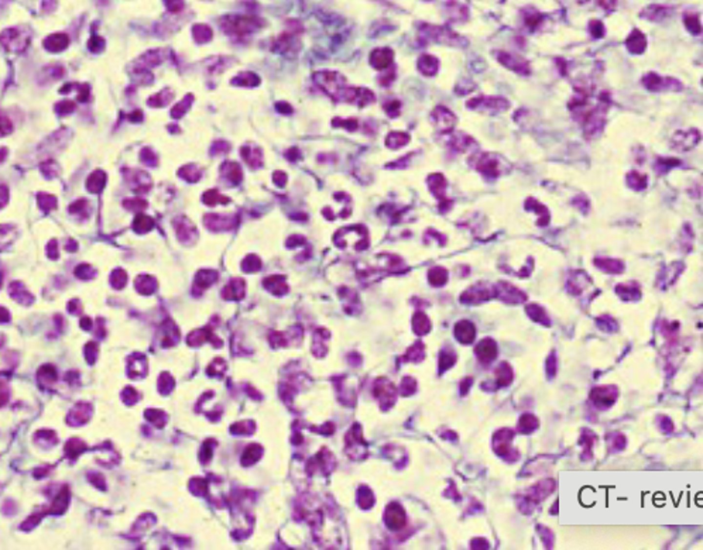 <p>What connective tissue type is shown in this image?</p>