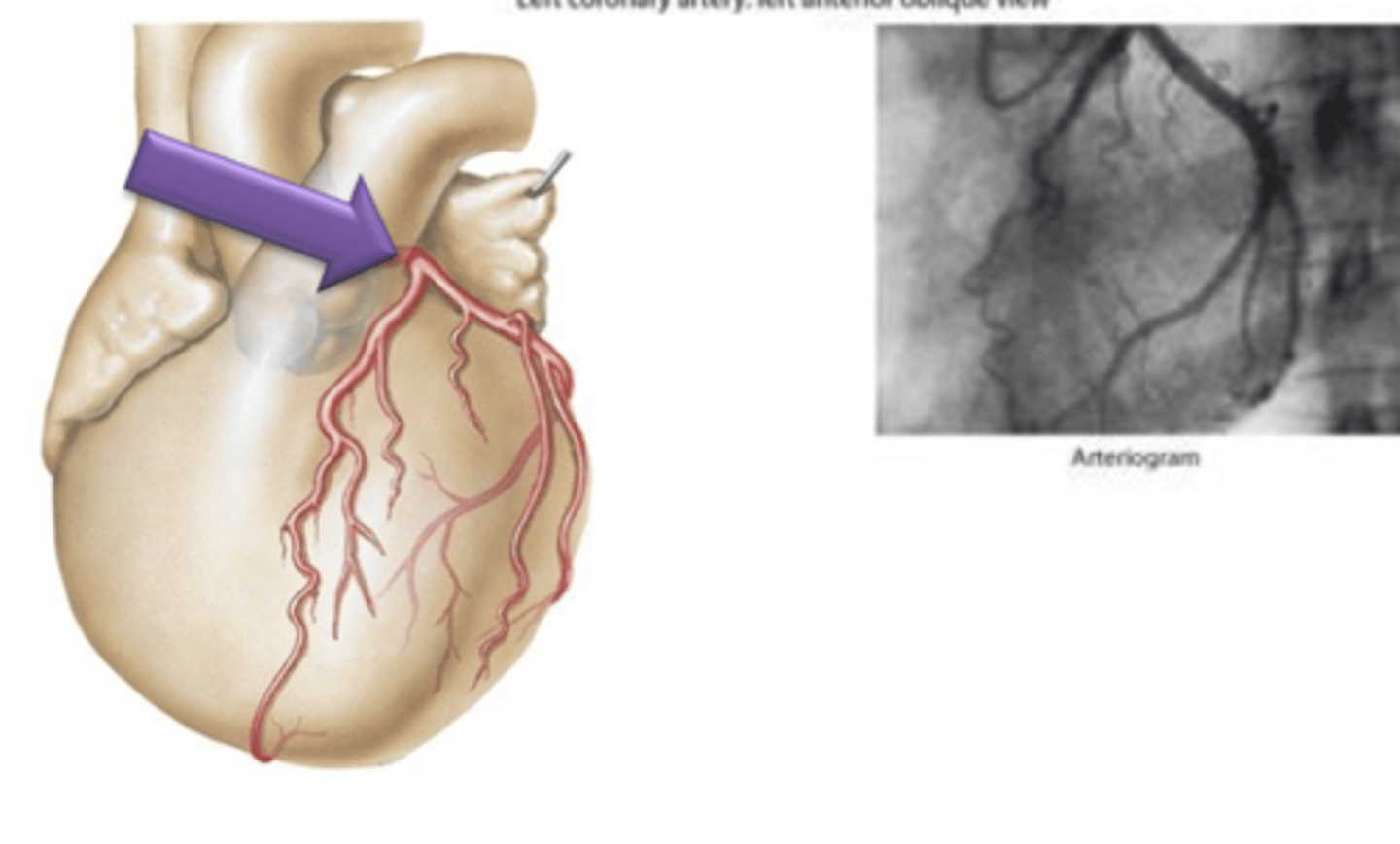 <p>Artery that originates from the left side of the aorta.</p>