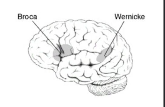<p>Wernicke 1874</p>