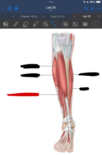 <p>What muscle is this?</p>