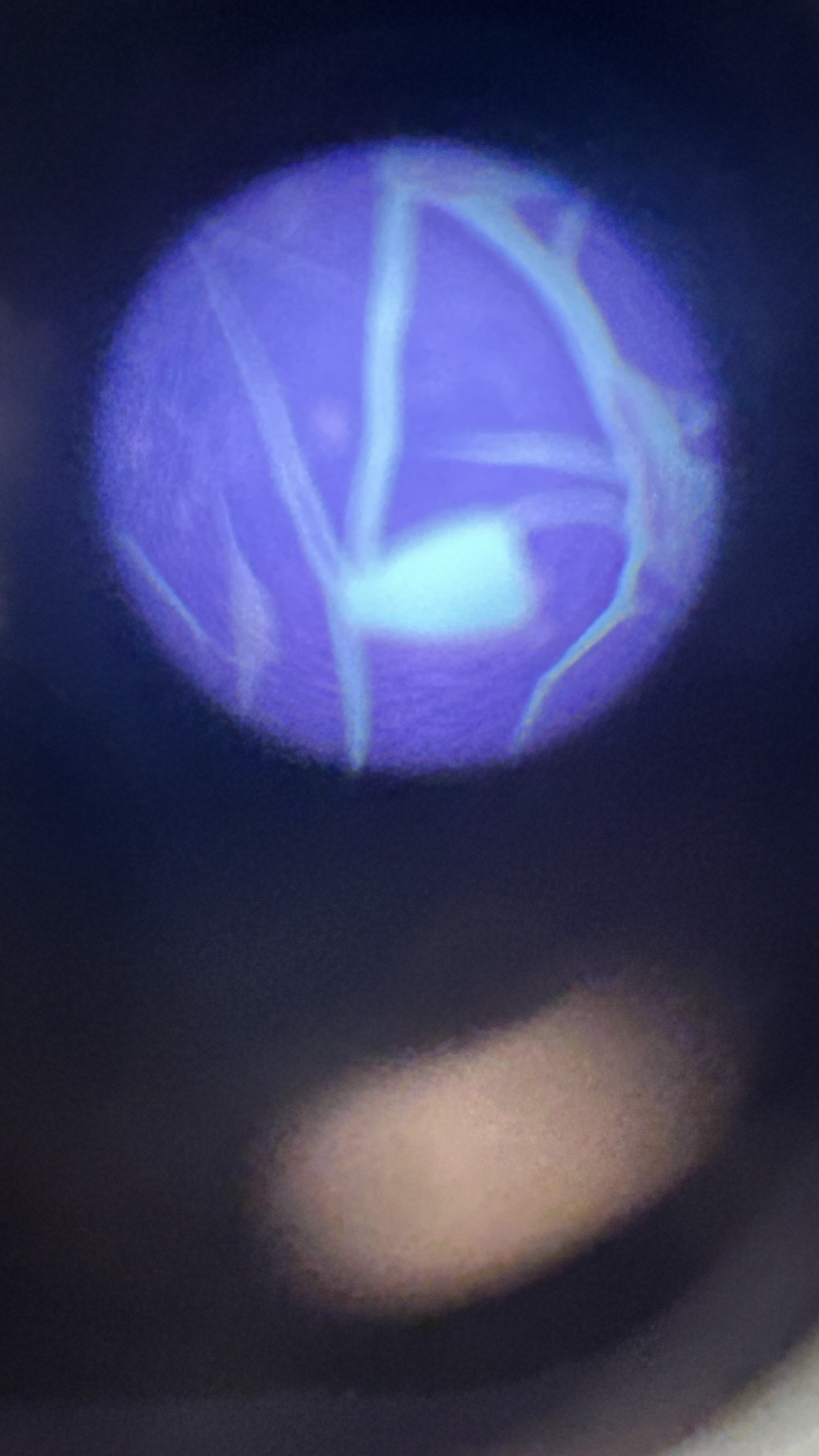 <p>What is the magnification level of the Reticular CT?</p>