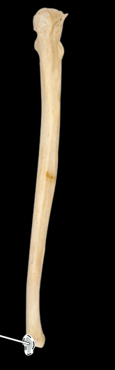 <p>Ulna, posterior view, right side</p>