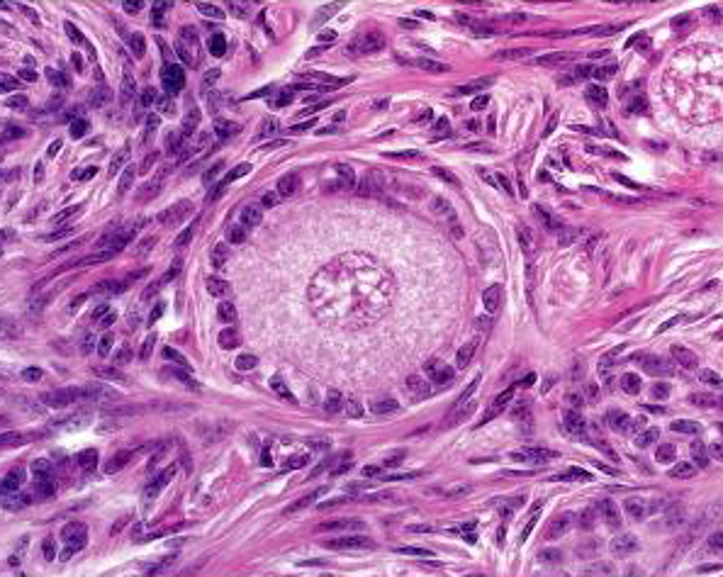 <p>a primary oocyte surrounded by >1 layer of cells</p><p>- look for space between oocyte and cells (zona pellucida)</p>