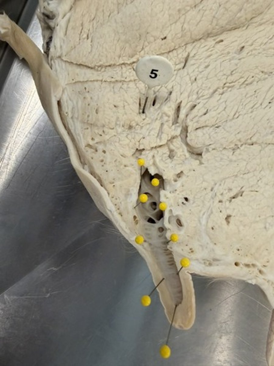 <p>a) ID the specific space indicated by the yellow pins.</p><p>b) Which specific passageway will empty into this space.</p>
