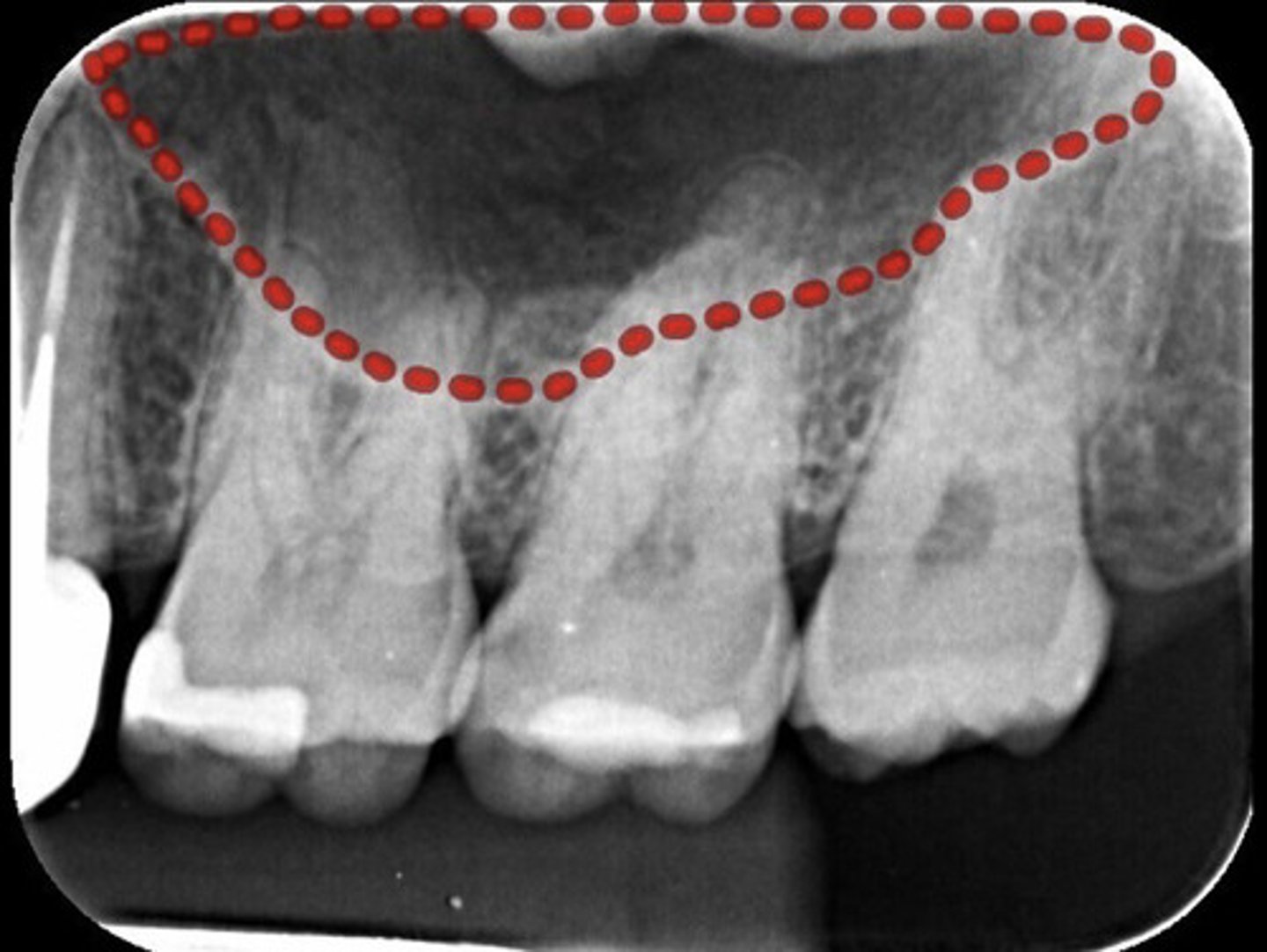 <p>What is the red dotted line representing?</p>