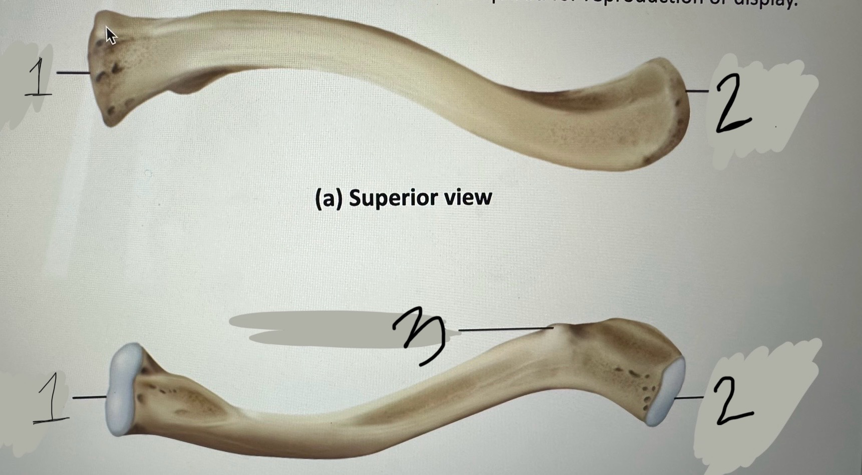 <p>Clavicle</p>