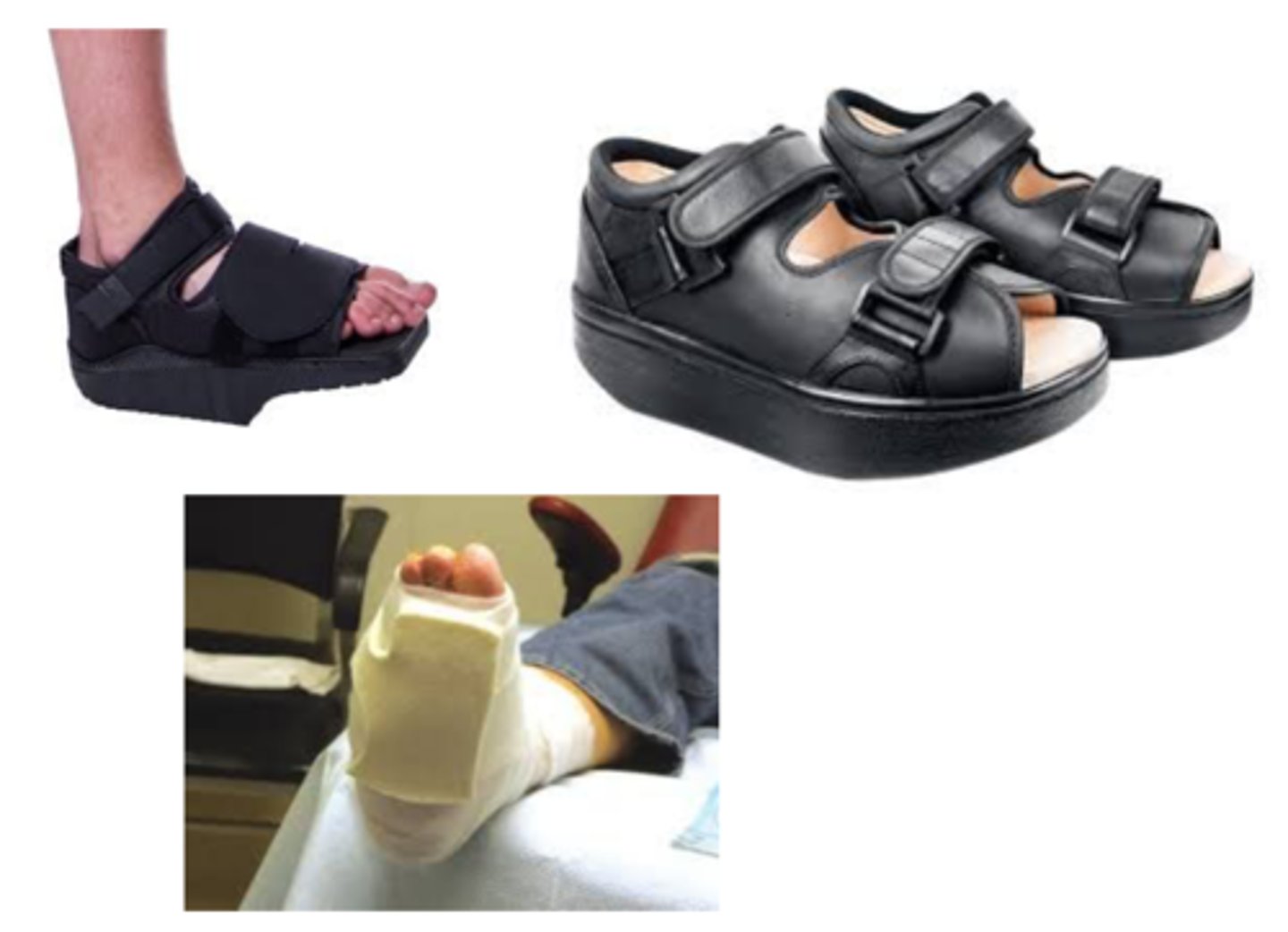 <p>- control blood glucose levels</p><p>(<150 for wound healing, A1C <8%)</p><p>- management of any PAD</p><p>- surgical debridement of any thick callus</p><p>- OFFLOADING IS ESSENTIAL</p><p>(footwear or total contact cast)</p><p>- nutrition</p><p>- foot, ankle ROM, strengthening, &amp; balance exercises</p><p>- daily foot checks, proper foot care and shoes</p>