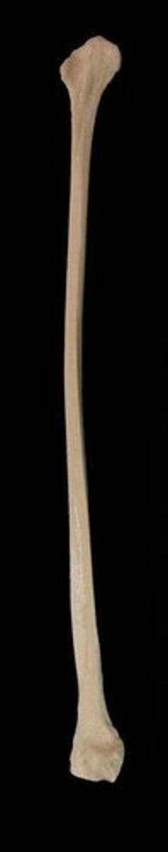 <p>ID bone</p>