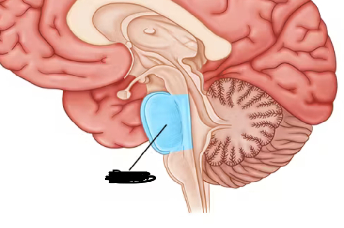 term image