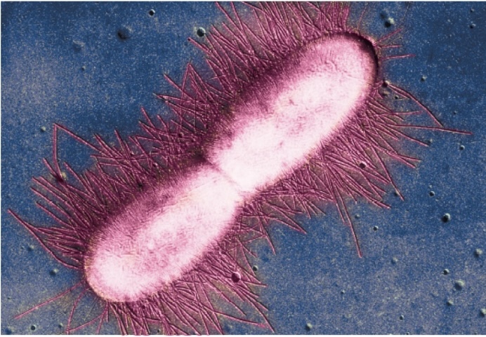 <p>Agent: <em>E. Coli </em></p><p>Most common cause for UTIs</p><p class="has-focus is-empty">Fecal/ Fecal oral for Travelers diarrhea </p><p class="has-focus is-empty"></p>