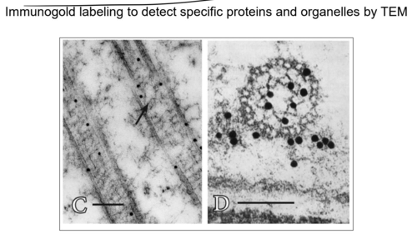 <p>Immunogold, or heavy metal ions, are used to detect particular proteins and organelles</p>