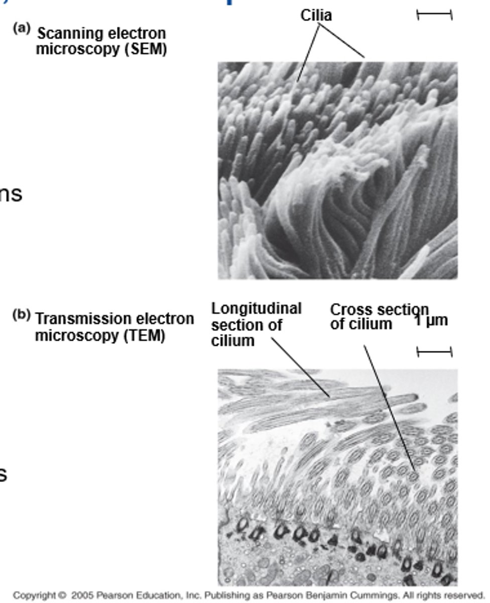 <p>1. scanning electron (SEMs)</p><p>- focus electron beam onto surface of specimen, providing images that look 3D</p><p>-- scans surface of cell</p><p>2. transmission electron (TEMs)</p><p>- focus electron beam thru specimen to study internal ultrastructure of cells</p>