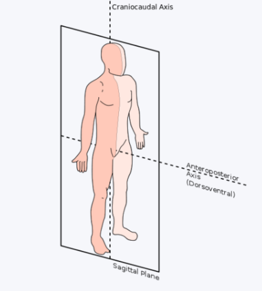 <p>Sagittal Plane</p>