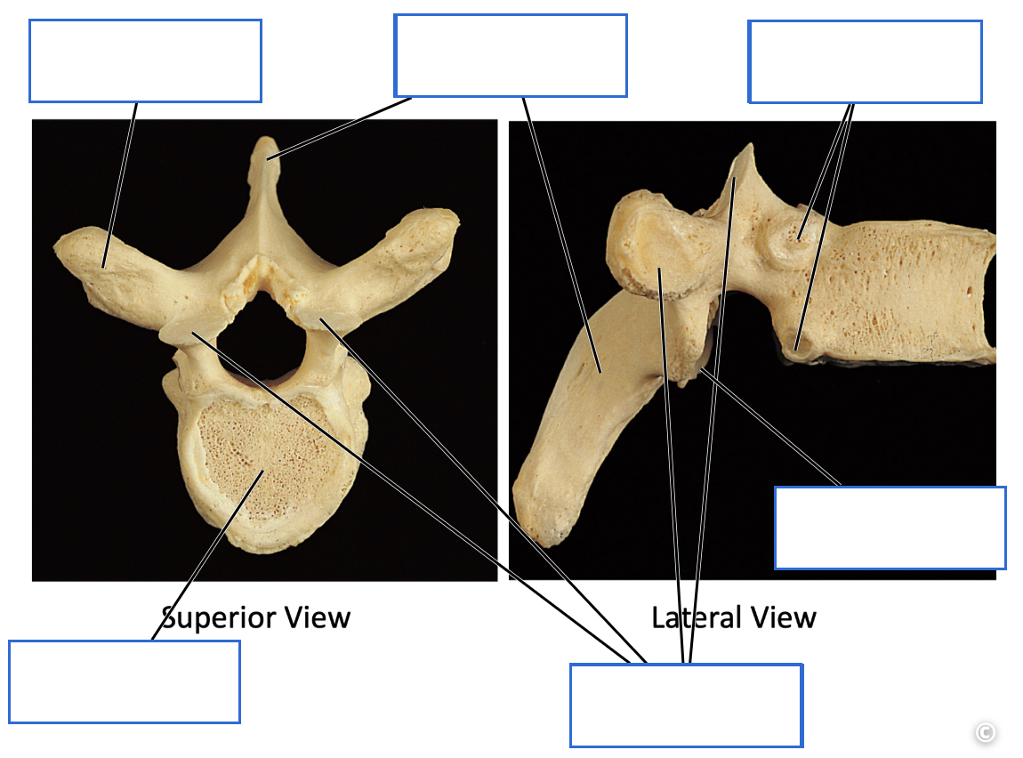 <p>Identify the bone features of the&nbsp;thoracic vertebrae</p>