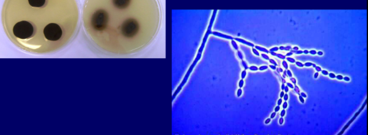 <p>Micro: shield cells detached from conidida, branching blastoconidia connected to each other</p><p>Macro: olive-black obverse, olive black reverse</p>