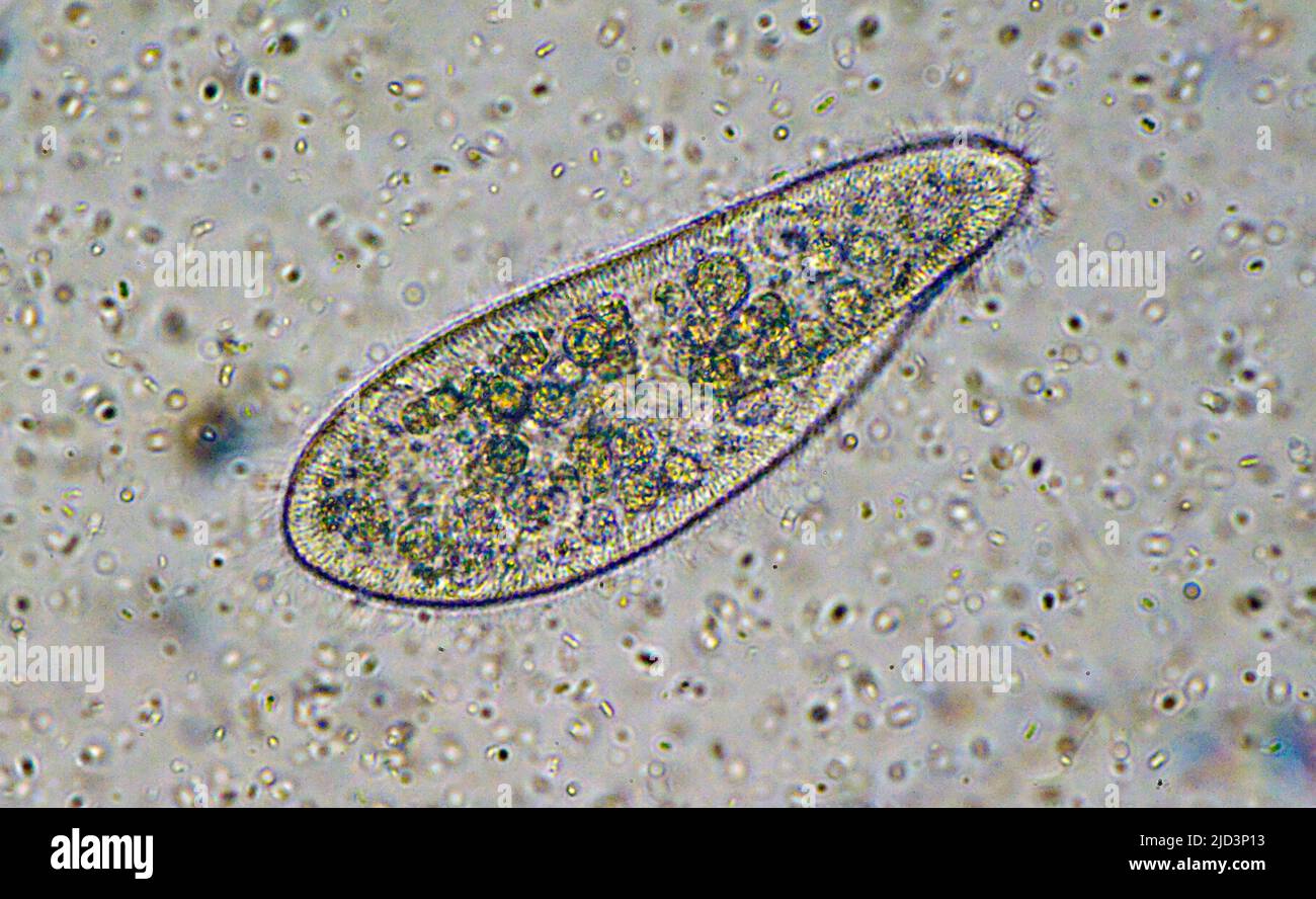<p>what microbe is this</p>