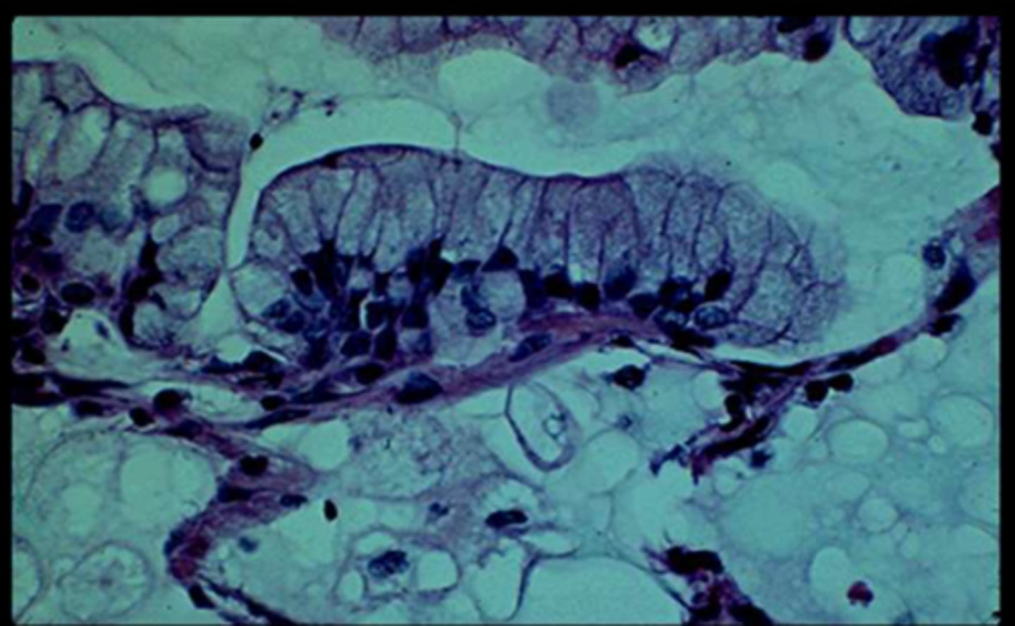 <p>histology shows a mucinous cell</p>