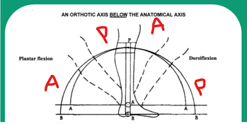 <p>Calf band moves ANTERIOR and PROXIMAL relative to the leg and resultant pressure is on the POSTERIOR aspect of the leg </p>