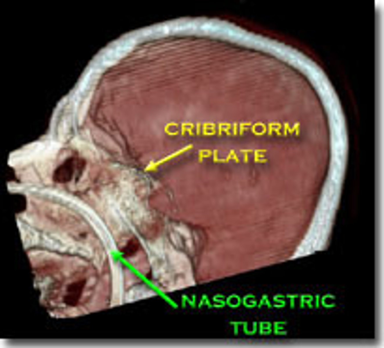 <p>(B) Cribriform Plate</p><p>The Cribriform Plate is lined with tiny holes and separates the olfactory epithelium from the human brain.</p>