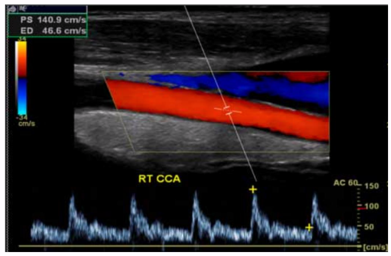 <p>the direction of flow for this carotid artery in this image is</p>