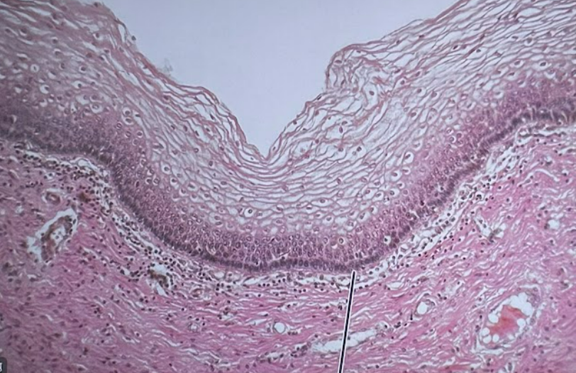 <p>Identify the structure at the <strong>POINTER</strong></p>