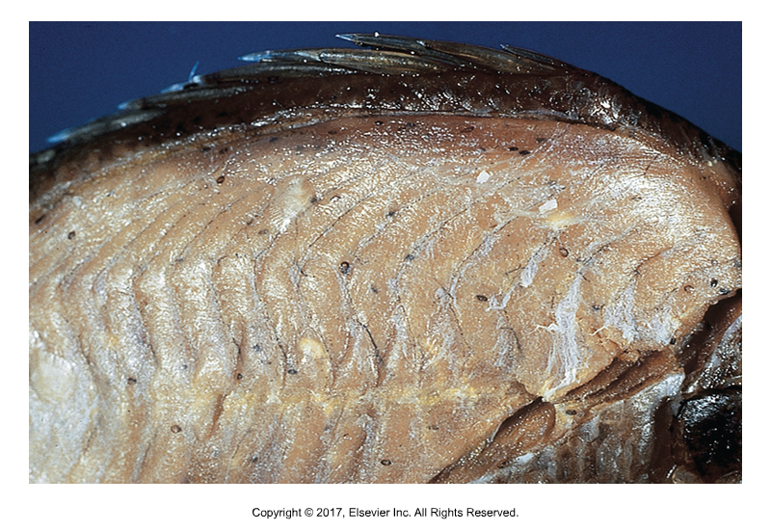<p>Avian blood flukes that release eggs into the water can infect snails and then release cercariae that infect fish. Metacercariae encyst in muscle and skin and fish increases melanin around them causing Black Spot. Cooked fish with Black Spot should not be able to infect humans, but birds can get infected by eating fish.</p>