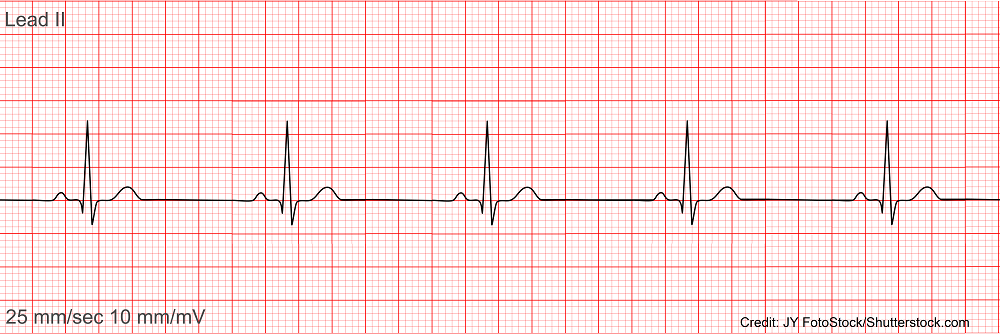 <p>What rhythm is this?</p>