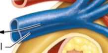 <p>what is this? kidney</p>